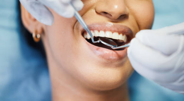 Best Root Canal Emergency Dentist  in Hayfork, CA