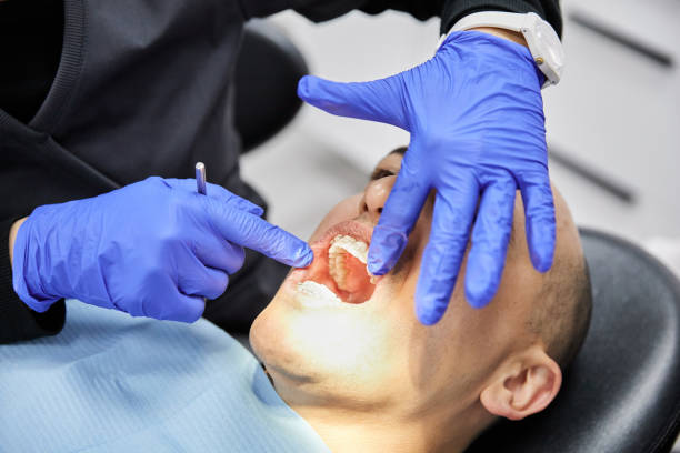 Best Teeth Whitening  in Hayfork, CA